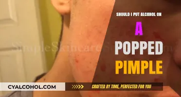 Alcohol on Popped Pimples: Effective Treatment or Skin Care Mistake?
