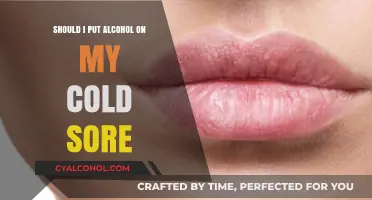 Alcohol on Cold Sores: Effective Remedy or Harmful Myth?