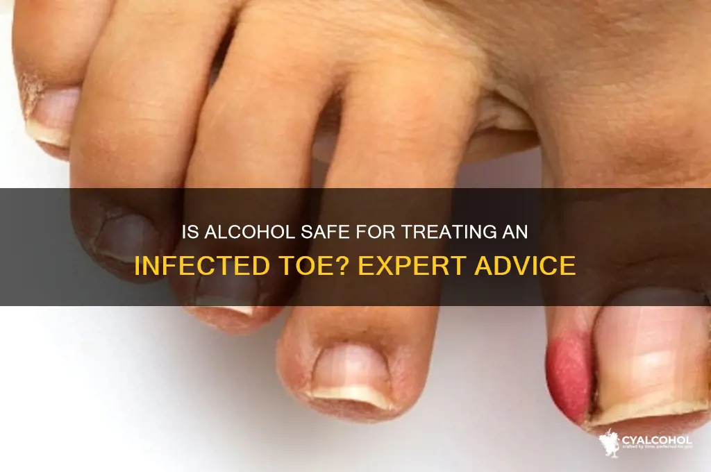 should i put alcohol on my infected toe
