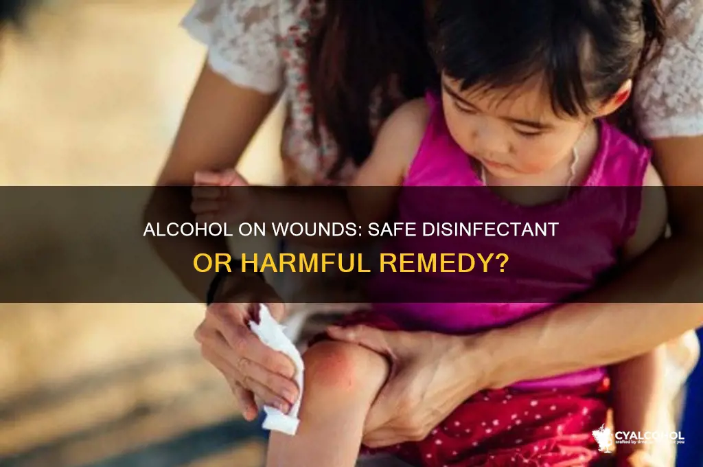 should i put alcohol on wound