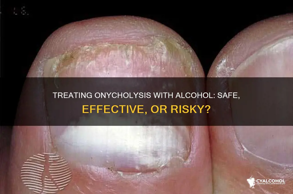 should i treat onycholysis with alcohol