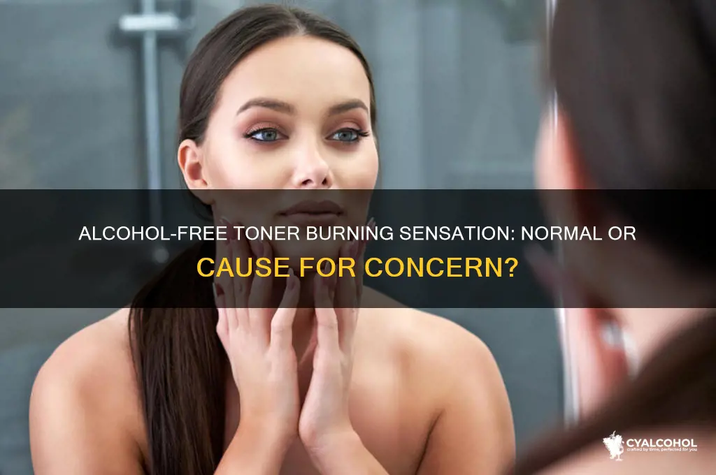 should my alcohol free toner burn