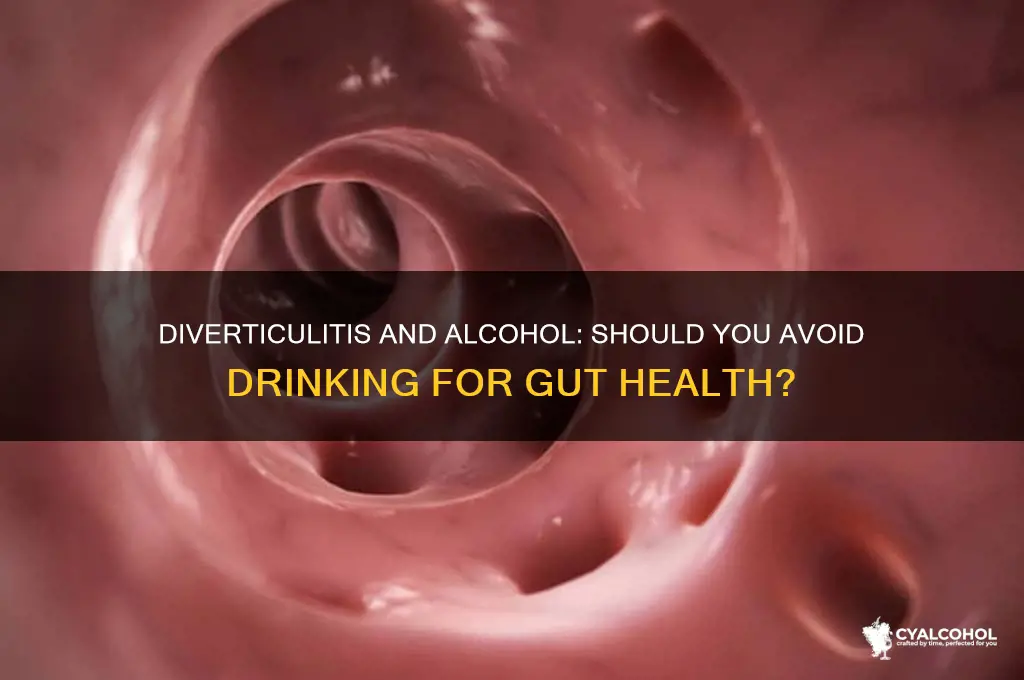 should you avoid alcohol with diverticulitis