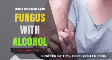 Alcohol for Skin Fungus: Effective Cleanser or Harmful Remedy?