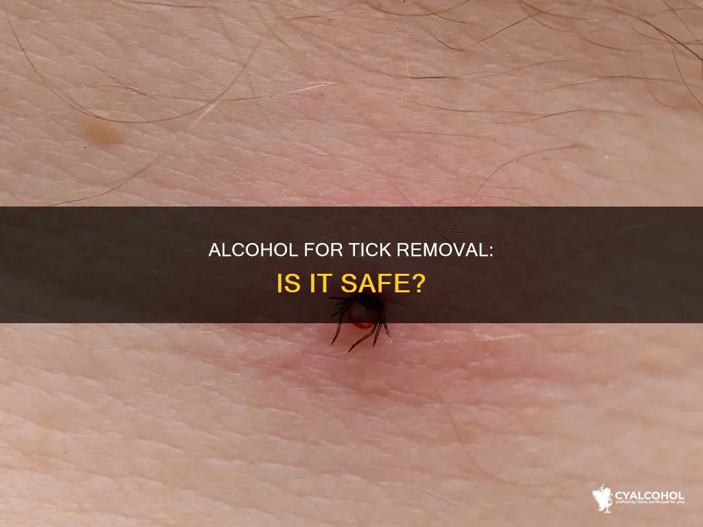 should you put alcohol on a tick before removing it