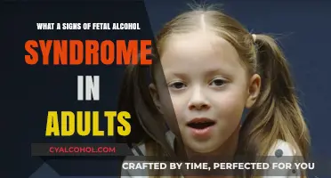 Fetal Alcohol Syndrome: Adult Signs and Symptoms