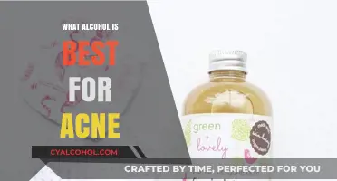 Best Alcohol-Based Toners for Acne-Prone Skin: A Clear Guide