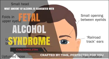 Alcohol Consumption and Fetal Alcohol Syndrome Risks