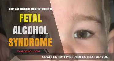 Understanding Fetal Alcohol Syndrome: Visible Physical Signs and Symptoms