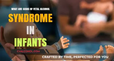 Fetal Alcohol Syndrome: Signs in Newborns