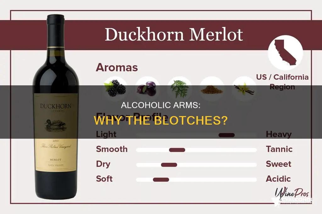 what are the blotches on the arms of older alcoholics