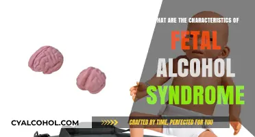 Understanding Fetal Alcohol Syndrome: Key Characteristics and Impact