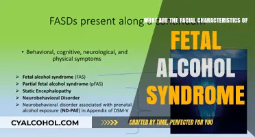 Fetal Alcohol Syndrome: Facial Indicators and Characteristics