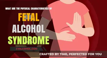 Fetal Alcohol Syndrome: Physical Traits and Characteristics