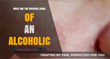 Recognizing Physical Signs of Alcoholism: Key Indicators to Watch For