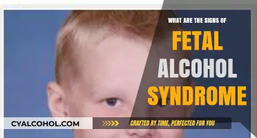 Recognizing Fetal Alcohol Syndrome: Key Signs and Early Indicators