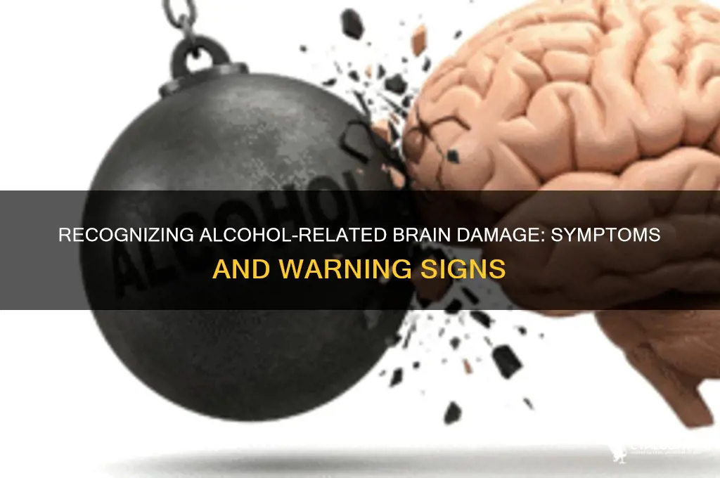 what are the symptoms of alcohol brain damage