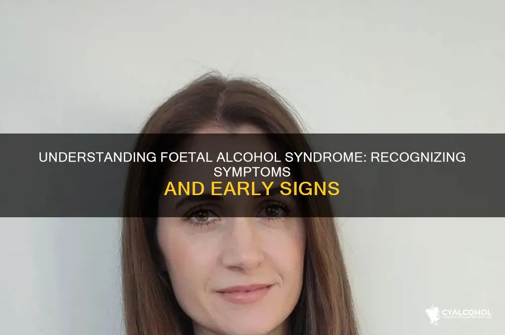 what are the symptoms of foetal alcohol syndrome