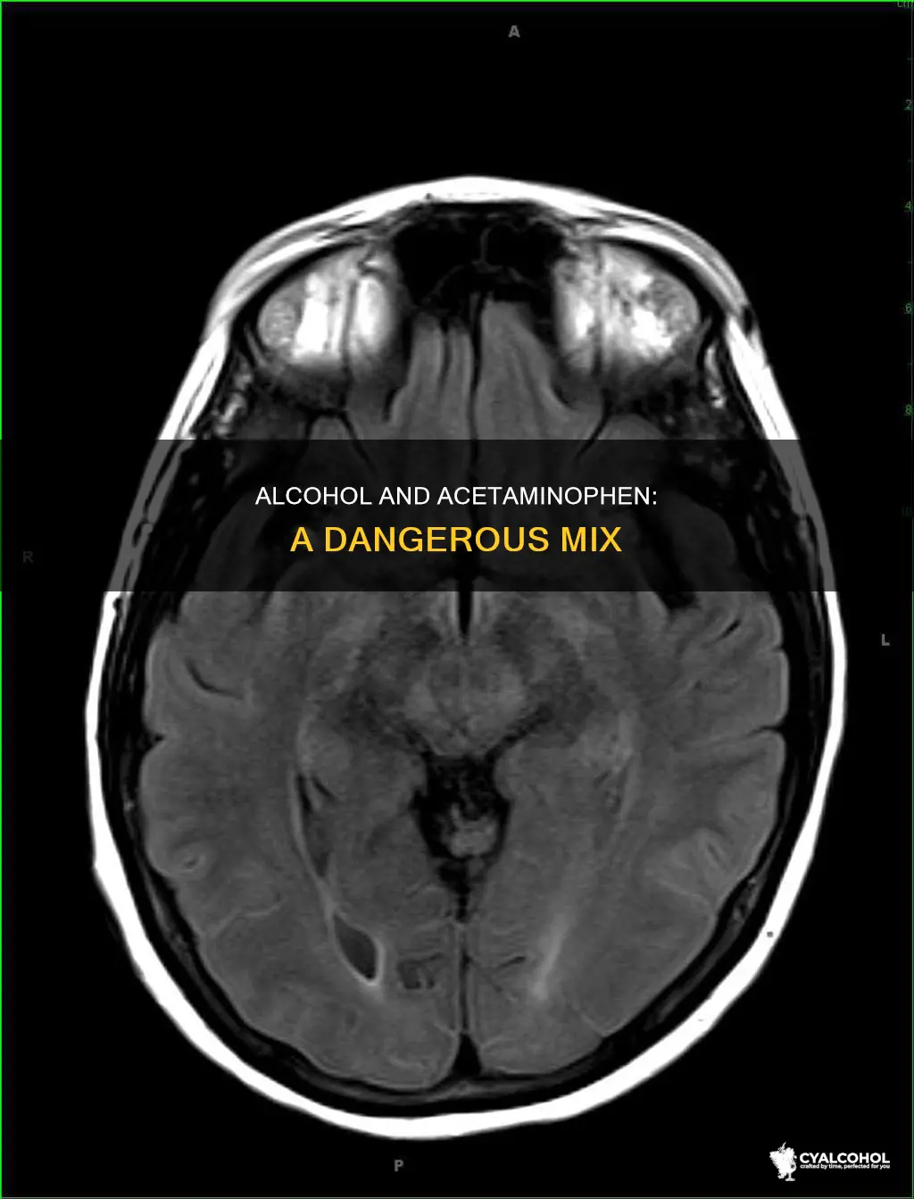 what are the symtoms of alcohol and acetomphine interaction