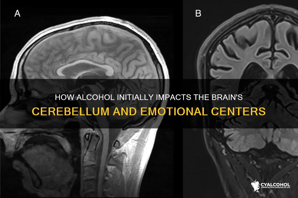 what brain structure is depressed first by alcohol