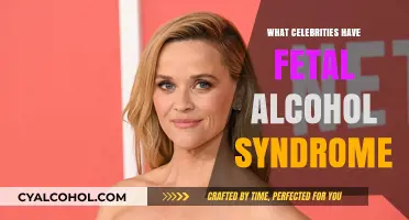 Celebrities Living with Fetal Alcohol Syndrome: Unveiling Hidden Struggles