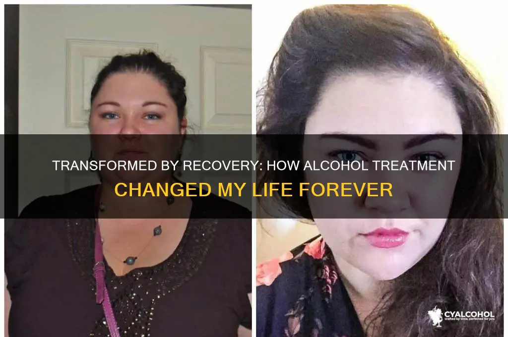 what changed me in alcohol treatment