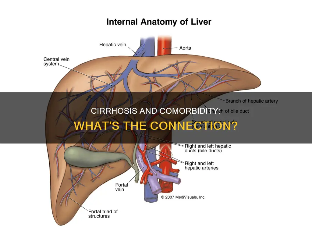 what comorbidity is typically diagnosed in patients with alcoholic cirrhosis
