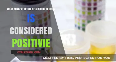Alcohol in Urine: What Level is Too High?