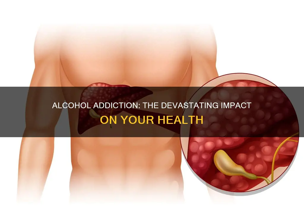 what condition is often a result of alcohol addiction