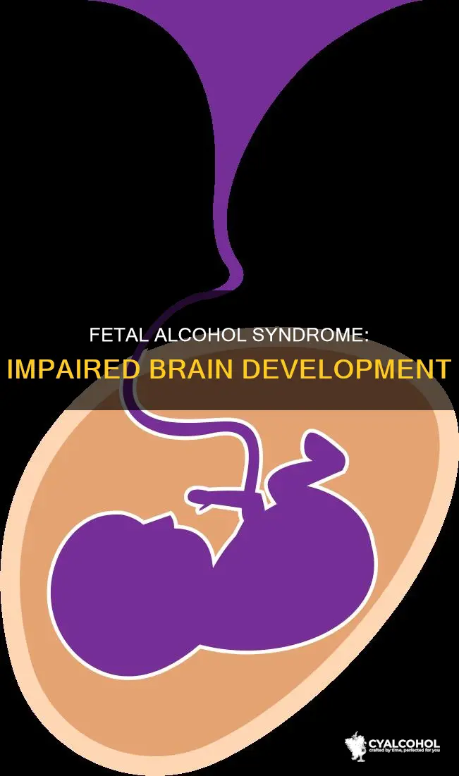 what developmental process of fetal alcohol syndrome is impaired