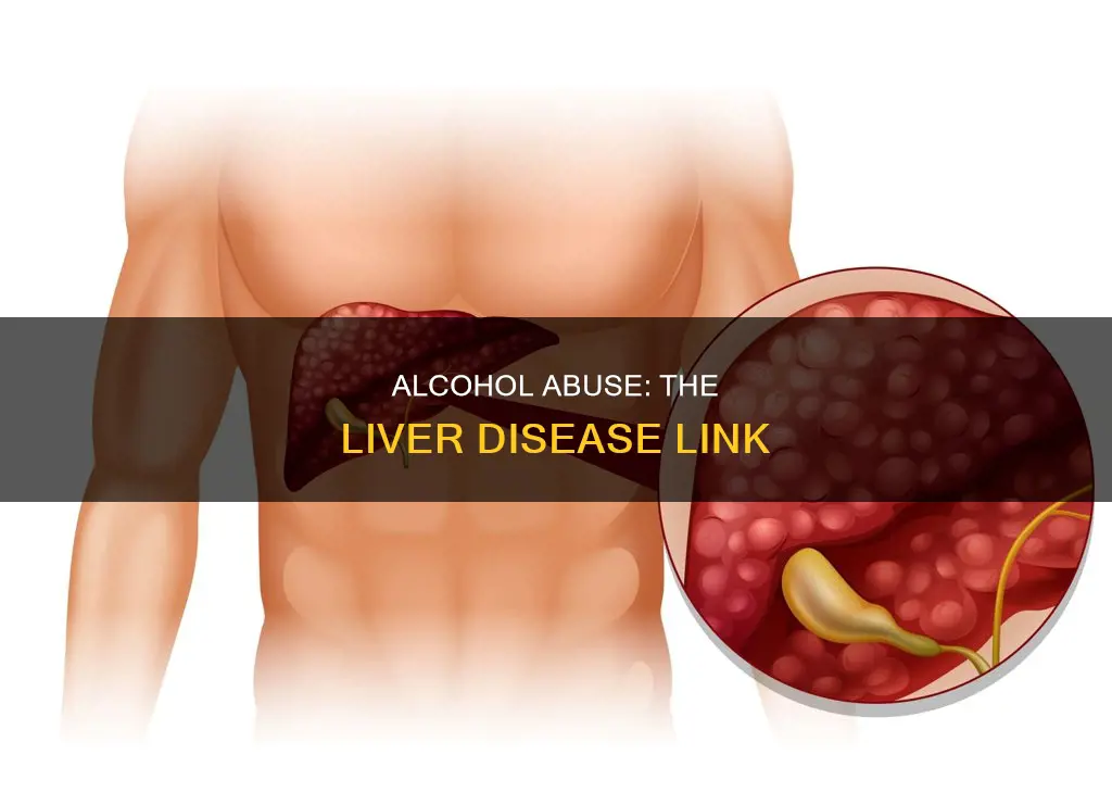 what disease is most strongly linked to heavy alcohol consumption