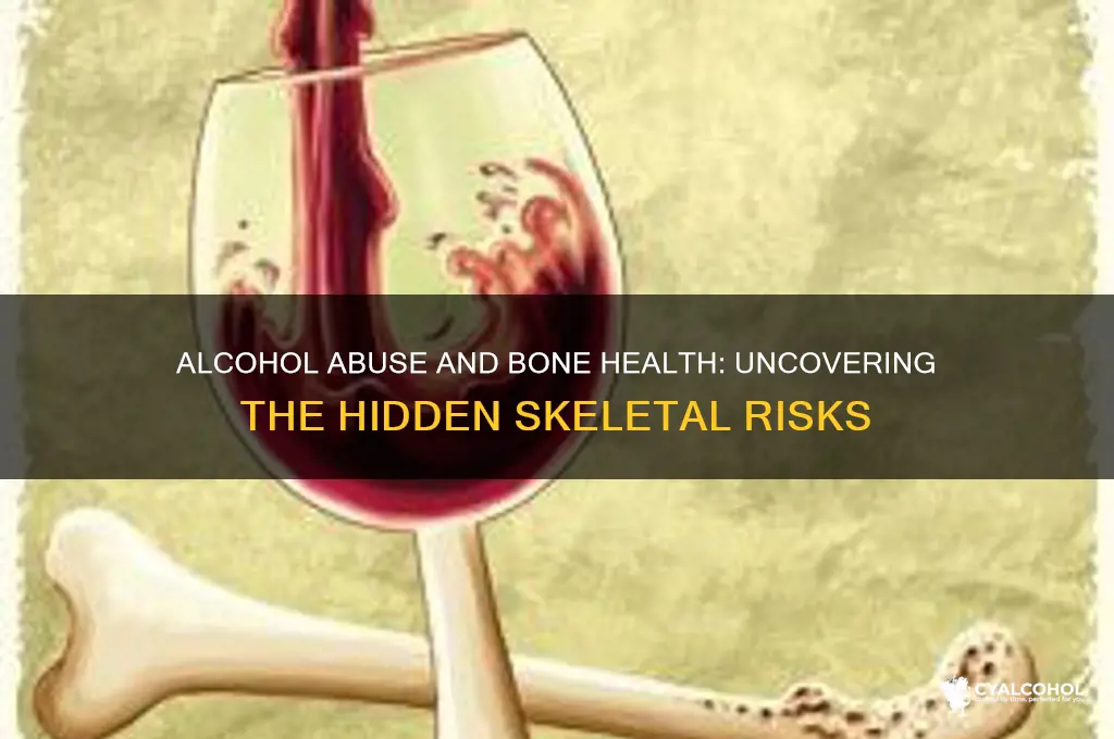 what does alcohol abuse do to the bones