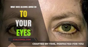 Alcohol Abuse and Eye Health: Uncovering the Damaging Effects