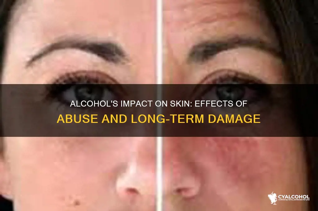 what does alcohol abuse do to your skin