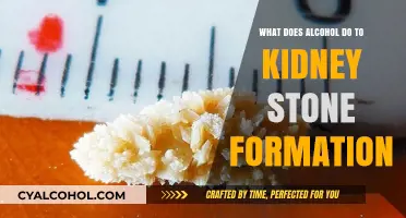 Alcohol's Impact on Kidney Stone Formation: Risks and Prevention Tips