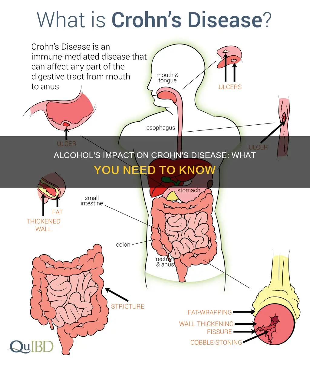 what does alcohol do to people with chrons dissease