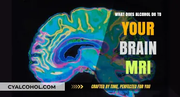 Alcohol's Impact on Brain MRI: Unveiling the Hidden Effects