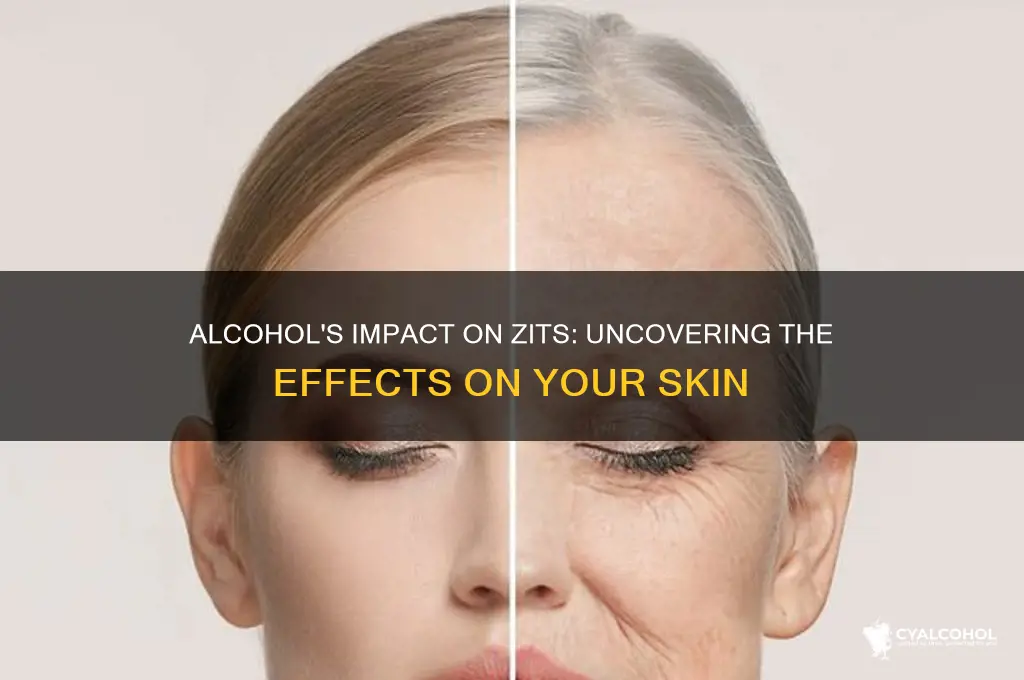 what does alcohol do to zits