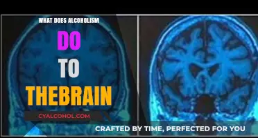 How Alcoholism Alters Brain Function and Structure Over Time