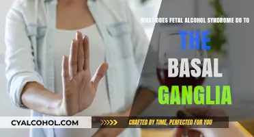 Fetal Alcohol Syndrome: Basal Ganglia Damage and Effects