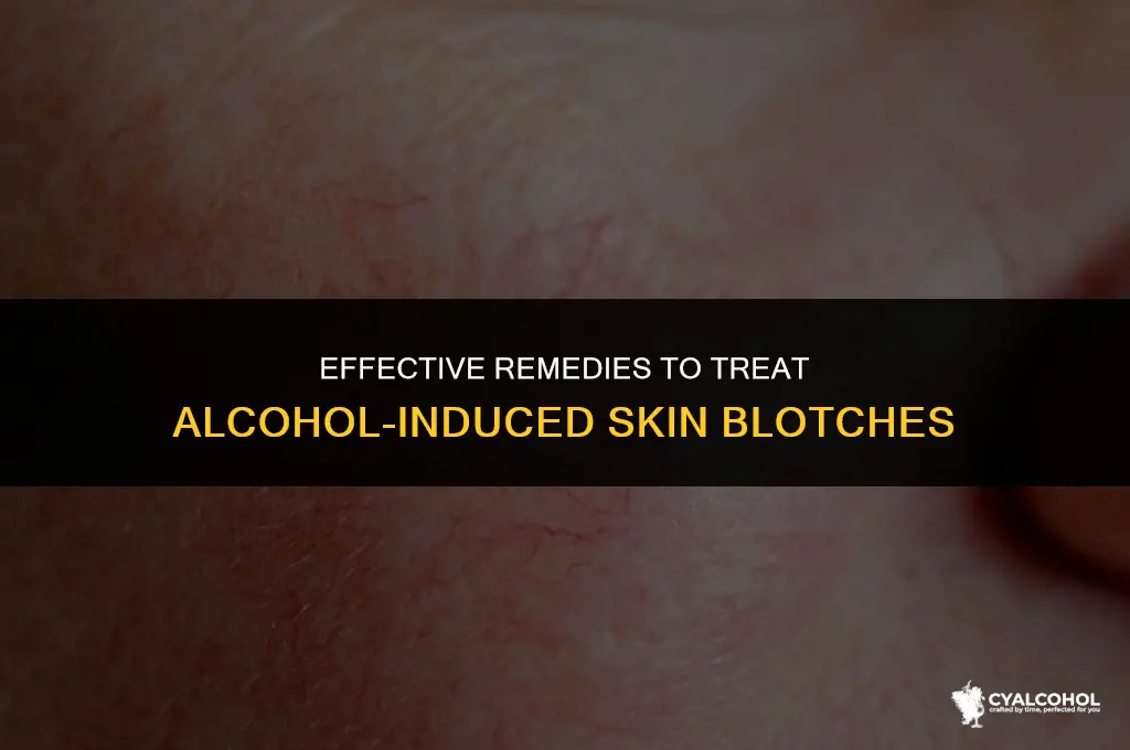what gelps with blotch from alcohol