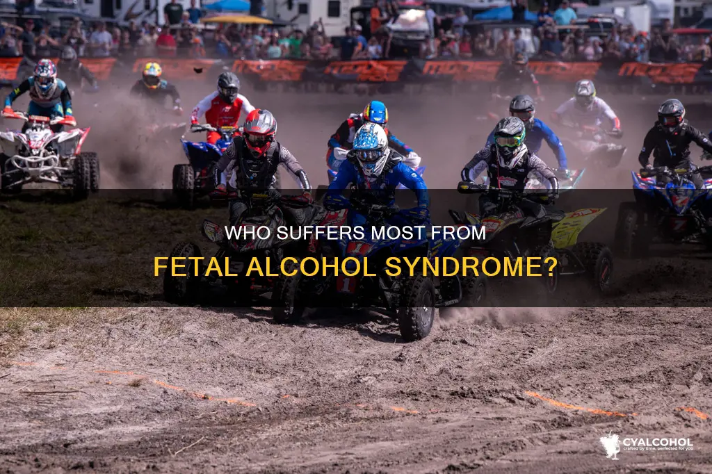 what group has the highest rate of fetal alcohol syndrome
