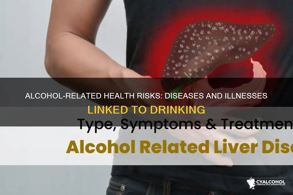 what illnesses or diseases are associated with alcohol