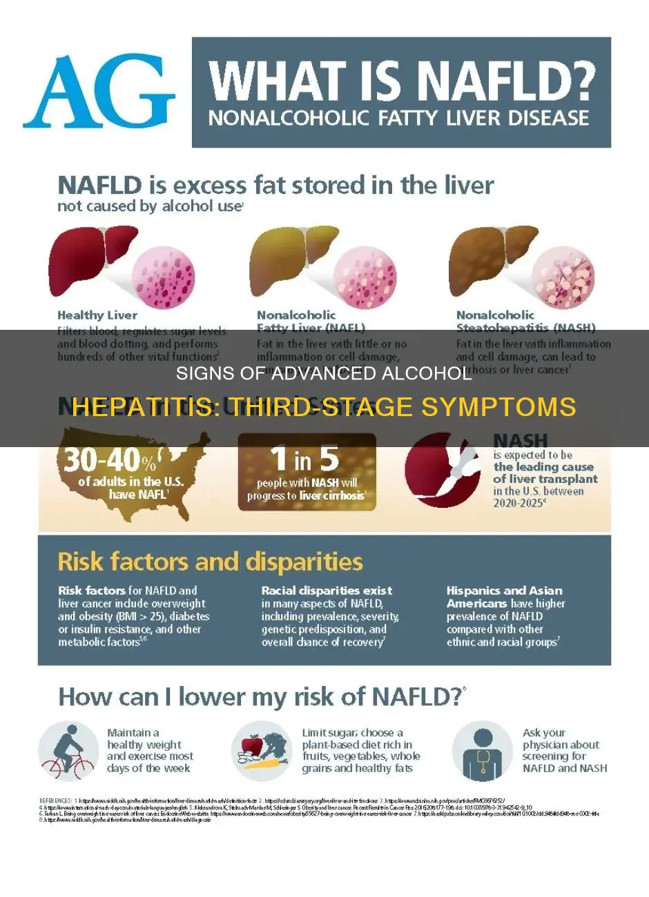 what indicates the presence of third-stage alcohol hepatitis