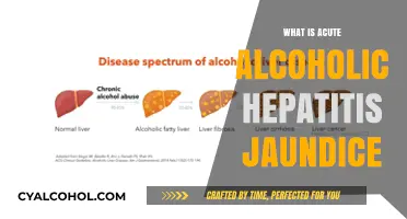 Understanding Acute Alcoholic Hepatitis: Causes, Symptoms, and Treatment