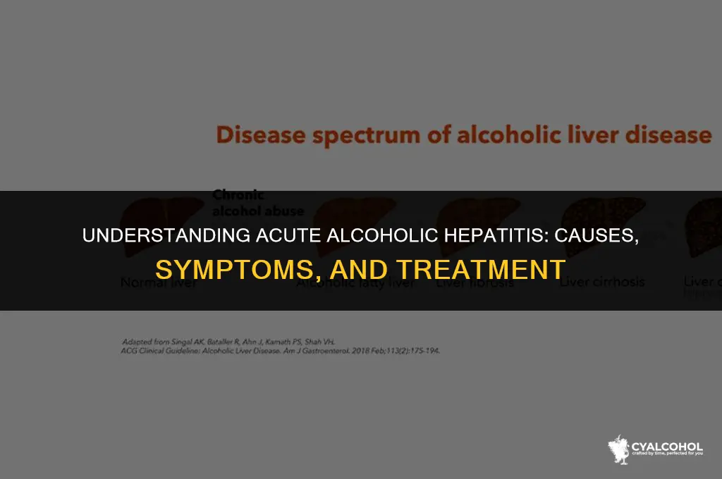 what is acute alcoholic hepatitis jaundice