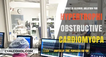 Alcohol Ablation: A Treatment for Hypertrophic Obstructive Cardiomyopathy Explained