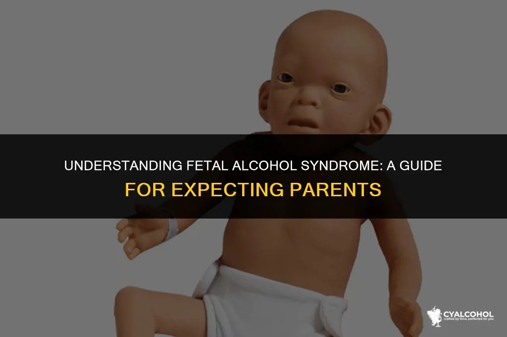 what is alcohol fetal syndrome baby