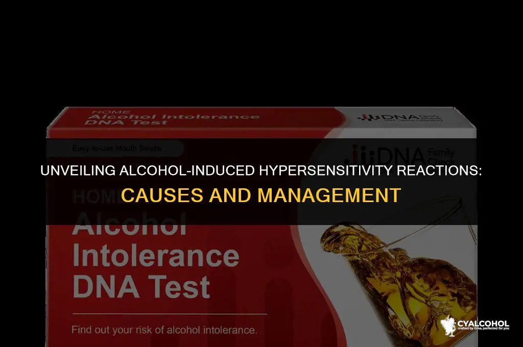 what is alcohol-induced hypersensitivity reactions