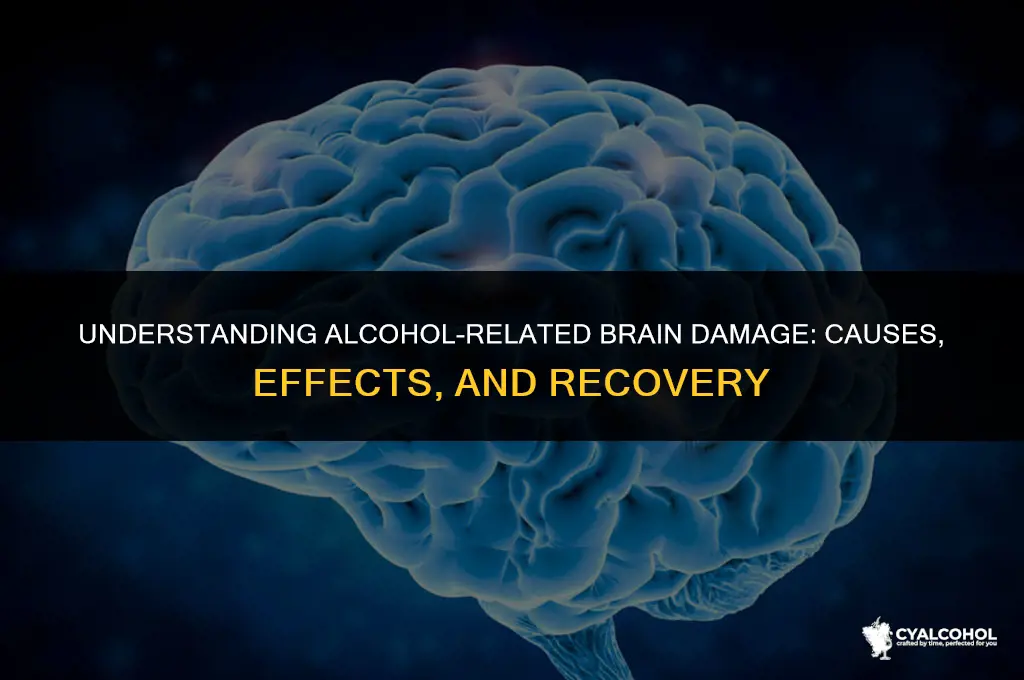 what is alcohol related brain damage